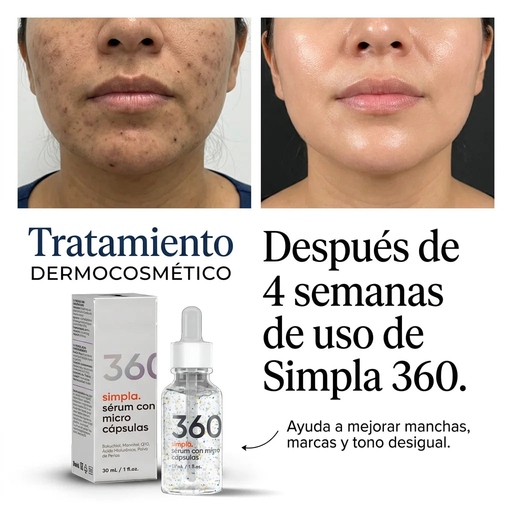 ¿Manchas, marcas de acné o cicatrices que no desaparecen?